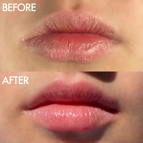 A close-up split image shows a persons lips, with the top section displaying dry and chapped lips, and the bottom section showing the same lips appearing smooth and hydrated BEFORE AFTER.