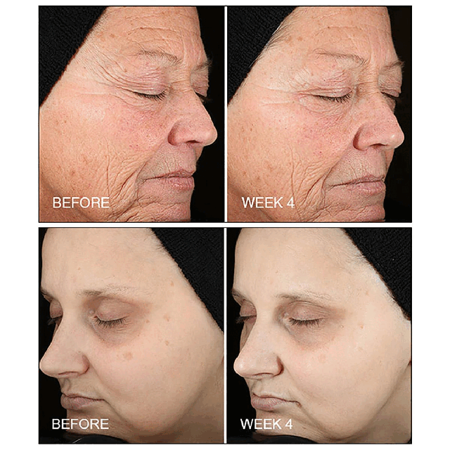 Image 1 an 2-Before and after shots
