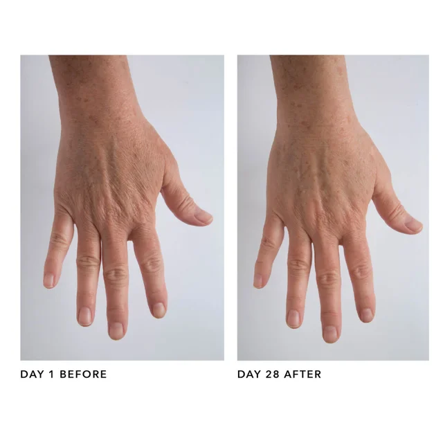 Day 1 before, Day 28 After