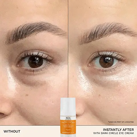 Image 1, WITHOUT REN *USED AS PART OF A ROUTINE INSTANTLY AFTER WITH DARK CIRCLE EYE CREAM Image 2, 92% SAID DARK CIRCLES WERE REDUCED *USER TRIAL AFTER 28 DAYS ON 77 VOLUNTEERS Image 3, BIOACTIVES → ELDERBERRY FLOWER EXTRACT reduces the appearance of dark circles → GLYCOGEN boosts radiance and evens skin tone → HYALURONIC ACID hydrates and smooths the eye area Image 4, ✓ BRIGHTENS DE-PUFFS ✓ HYDRATES ✓ PLUMPS ✓ SMOOTHS SUITABLE FOR SENSITIVE SKIN Image 5, INFINITY RECYCLED PLASTIC REN CLEAN SKINCARE BRIGHTENING DARK CIRCLE EYE CREAM SOIN ÉCLAT CONTOUR DES YEUX ANTI-CERNES RADIANCE CCLAT 15mle/0.5fl. oz. US Image 6, STEP 01 CLEANSE STEP 02 EXFOLIATE REN REN 250-85 US JELLY OIL CLEANSER READY STEADY GLOW DAILY AHA TONIC STEP 03 TARGET STEP 04 HYDRATE REN REN BRIGHTENING DARK CIRCLE EYE CREAM DARK SPOT SLEEPING CREAM