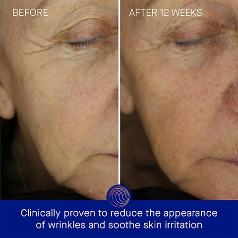 Image 3 - A side-by-side comparison of a womans face, with the left side labeled BEFORE showing noticeable wrinkles and the right side labeled AFTER 12 WEEKS showing a smoother appearance, with text at the bottom reading clinically proven to reduce the appearance of wrinkles and soothe skin irritation.
Image 4 - A blue jar of Augustinus Baders Ultimate Soothing Cream is displayed with text highlighting clinically proven results: skin hydration is improved by 2.8x, fine lines are visibly reduced by 78%, and the appearance of wrinkles is reduced by 79%.
Image 5 - Image of a blue cream jar with a gold lid and text highlighting user satisfaction: 100% agree irritated skin feels instantly soothed and calmed, 95% agree skin barrier feels balanced and restored, 100% agree skin feels nourished and replenished, with a note about a consumer perception study.
Image 6 - A blue jar of Augustinus Baders ultimate soothing cream with a bronze lid is shown against a gradient background, with text detailing the benefits of TFC8, Totarol, Evening Primrose, and Black Cumin Oil.
Image 7 - A blue jar of Augustinus Bader The Ultimate Soothing Cream with a gold lid is shown on the left, and on the right, there is a circular refill container with the same product details, both displaying the text 50ml and 50ml Refill.
Image 8 - A graphic showing a skincare routine titled The Routine, featuring four steps: 1. Cleanse with THE CREAM CLEANSING GEL; 2. Correct & Hydrate with THE SERUM; 3. Nourish & Renew with THE ULTIMATE SOOTHING CREAM; and 4. Perfect & Revitalize with THE EYE CREAM, accompanied by product images.