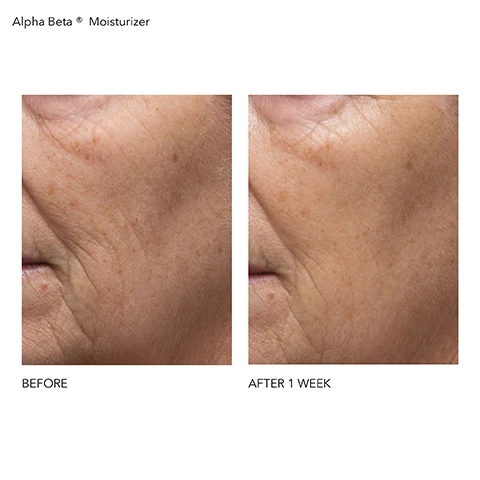 Image 1, before and after 1 week. image 2, before and after 2 weeks