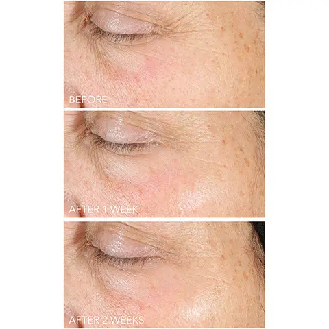 Image 1 to 2, Before and After results shots