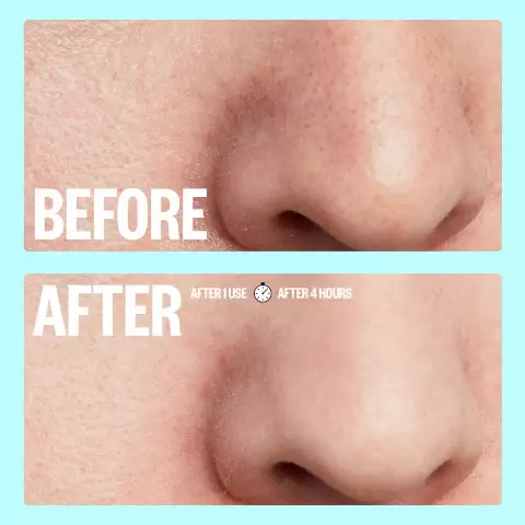 Image 1, before and after 1 use, after 4 hours. Image 2, before and after, the more you use pores the better they work, see instant gunk removel in 4-6 hours and refine the look of pores with each use. Image 3, peace out pores, the ingredients. new, clean hydrocolloid technology and pore refining ingredients to minimse the look of pores in 4-6 hours. hydrocolloid polymer technology - lifts away dirt, excess sebum and dead skin cells from within your pores. DMAE visibly shrinks enlarged pores for firmer looking skin. retinol helps minimize and refine the appearance of pores.