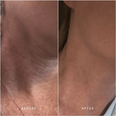 Image 1, BEFORE AFTER Image 2, BEFORE AFTER