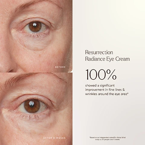 Image 1 - Image showing a close-up comparison of two eyes, with the upper image labeled BEFORE showing more visible fine lines and wrinkles, and the lower image labeled AFTER 4 WEEKS showing smoother skin; accompanying text states Resurrection Radiance Eye Cream, 100% showed a significant improvement in fine lines & wrinkles around the eye area* and a note about the study.
Image 2 - A side-by-side comparison of a persons eye area, showing before treatment labeled BEFORE on the top and after treatment labeled AFTER 4 WEEKS on the bottom, with text stating Resurrection Radiance Eye Cream 100% showed a significant improvement in the hydration around the eye area after 24 hours* on the right.
Image 3 - Image of a brown jar labeled True Botanicals Resurrection Radiance Eye Cream, with statistics showing 100% improvement in hydration around the eye area in 24 hours, 100% improvement in fine lines and wrinkles after 6 weeks, 112% increase in hydration after 6 weeks, and 94% reduction in puffiness after 6 weeks, along with a small note about an independent scientific clinical study.
Image 4 - An image of a cream product titled Resurrection Radiance Eye Cream, featuring a beige background with a list of benefits that include reducing fine lines, brightening dark circles, and being pregnancy safe, along with various logos indicating it is dermatologist tested, vegan, and cruelty-free.
Image 5 - A jar of True Botanicals Resurrection Radiance Eye Cream is placed on a textured surface surrounded by ingredients like turmeric, coffee, licorice, and tree bark, with text that reads Resurrection Plant, Turmeric, Coffee, & Licorice Extract, and Tree Bark Extract.
Image 6 - Image shows a clean, white background with a prominent logo that reads MADE SAFE at the center, followed by the website URL www.madesafe.org; the text below explains the certification of True Botanicals products, listing substances that are banned and certifications the products hold, including PETA approved and dermatologist tested, along with symbols for EWG certification, cruelty-free, and sustainably sourced.