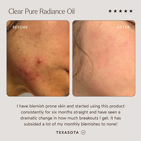 Image 1 - Image shows a side-by-side comparison of skin before and after using Clear Pure Radiance Oil, with the left side displaying blemishes and redness and the right side showing clearer skin; additional text reads I have blemish prone skin and started using this product consistently for six months straight and have seen a dramatic change in how much breakouts I get. It has subsided a lot of my monthly blemishes to none! TEXASOTA.
Image 2 - Side-by-side images show a persons face before and after using Clear Pure Radiance Oil, with the left side displaying acne and blemishes, while the right side shows clearer skin and a smiling expression; below the images is the text This saved my skin from hormonal acne and is the only face oil Ill use now, along with the name Makenzie W.
Image 3 - Image of a golden background with bubbles and the text Clear Pure Radiance Oil at the top, followed by a list of benefits including Prevent Breakouts & Balance Oiliness, Smooths fine lines & wrinkles, Evens skin tone & complexion, Prevents breakouts, Deeply hydrates to balance oiliness, Non-Comedogenic, Dermatologist tested, Hypoallergenic, and Pregnancy safe, with various certification logos at the bottom.
Image 4 - Image of a brown glass dropper bottle labeled True Botanicals Pure Radiance Oil with a black dropper cap, surrounded by yellow helichrysum flowers and orange oil, alongside text describing the benefits of its ingredients: Algae Extract & Astaxanthin fights signs of aging and restores glow while Hemp, Pumpkin & Grape Seed Oils balance skin sebum for optimal pH balance.
Image 5 - Three bottles of facial oils sit stacked vertically against a light background, with visible text on the image that reads, Which Oil is Right for You? followed by descriptions of each oil: Renew Pure Radiance Oil - nourishing oil, addresses signs of aging, normal to dry skin, floral and woody; Clear Pure Radiance Oil - balancing oil, addresses problem-prone skin, blemish-prone to oily skin, herbal and earthy; Calm Pure Radiance Oil - soothing oil, calms and soothes irritated skin, sensitive to reactive skin, fresh and earthy.
Image 6 - Image shows a promotional graphic for True Botanicals products, highlighting the MADE SAFE certification, listing a series of banned ingredients such as Sodium Lauryl Sulfate and parabens, and includes a note on the product being dermatologist tested and sustainably sourced. Text includes: MADE WITH SAFE INGREDIENTS, MADE SAFE, www.madesafe.org, Every True Botanicals product is certified MADE SAFE which... known toxic substances protect people and the planet, Sodium Lauryl Sulfate (SLS), Phthalates or Synthetic Fragrances, Parabens or Phenoxyethanol, Fillers, Silicones, Chemical Sunscreens, Dermatologist Tested, EWG Certified, Microbiome Friendly, Vegan & Cruelty-Free, Hypoallergenic, Sustainably Sourced, PETA APPROVED, MADE SAFE, EWC CERTIFIED, PACT, 1 FOR THE PLANET, FSC.