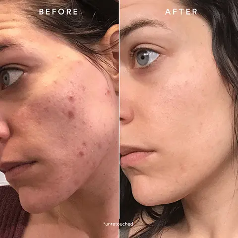 Image 1, before and after unretouched. Image 2, before and after unretouched.