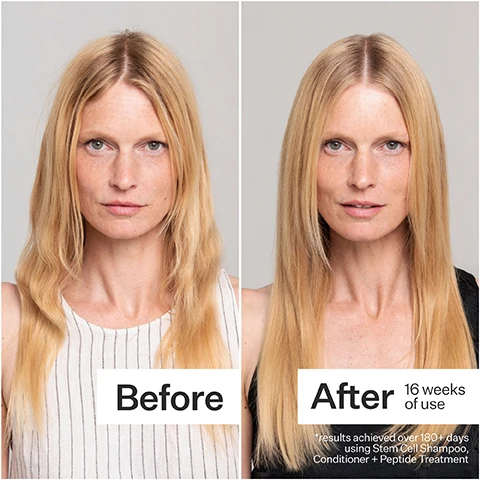 Image 1 - Image shows a side-by-side comparison of a woman’s hair before and after 16 weeks of using a hair treatment, with the left side labeled Before showing wavy hair and the right side labeled After showing straight, smoother hair. Below the images is text that reads results achieved over 180+ days using Stem Cell Shampoo, Conditioner + Peptide Treatment.
Image 2 - A middle-aged woman with long, flowing gray hair smiles gently while facing slightly towards the camera against a plain light background.
Image 3 - Two bottles of Act + Acre Cold Processed Stem Cell Shampoo and Conditioner submerged in water, with visible text indicating the product names.
Image 4 - Image shows a comparison of hair before and after treatment; the left side displays wavy, frizzy hair labeled Before, while the right side features smooth, straight hair labeled After, with additional text stating 16 weeks of use and results achieved over 180+ days using Stem Cell Shampoo, Conditioner & Peptide treatment.
Image 5 - Image of three hair care products displayed on a light background, including a small spray bottle labeled 3% Stem Cell Peptide Scalp Treatment, a larger bottle labeled Cold Processed Stem Cell Shampoo, and another larger bottle labeled Cold Processed Stem Cell Conditioner, with the heading The Stem Cell™ System and a description stating Trichologist developed system formulated to support hair follicle health for fuller + thicker looking hair.
Image 6 - An infographic titled Your Scalp Routine outlines a three-step process: Step 1 is Stem Cell Shampoo with benefits of cleansing, volumizing, and invigorating using caffeine; Step 2 is Stem Cell Conditioner with benefits of moisturizing, strengthening, and restoring using H2-Grow Complex™; Step 3 is Peptide Treatment with benefits of stimulating, nourishing, and balancing using H3-Grow+ Complex™.
Image 7 - Image shows a graphic explaining the benefits of the Cold Processed® method, with a bar graph illustrating that 97% of nutrients are retained with Cold Processed® compared to 10% retained with heat processing, and text states that Cold Processed® method uses -30° hyperbaric chamber to preserve bioactive ingredients.
Image 8 - A person holds two bottles of hair care products, labeled as Cold Processed Stem Cell™ Shampoo and Cold Processed Stem Cell™ Conditioner, with icons indicating key ingredients, application instructions for in-shower use, and proven benefits such as preventing damage and optimizing for fine/thin hair.
