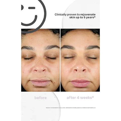 before Clinically proven to rejuvenate skin up to 5 years* after 4 weeks* *BASED ON AN INDEPENDENT CLINICAL STUDY | DEMOGRAPHICS: WOMEN, AGES 35-65 | NUMBER OF PARTICIPANTS