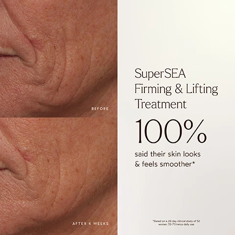 Image 1 - Image shows a side-by-side comparison of facial skin before and after using SuperSEA Firming & Lifting Treatment, with visible text stating SuperSEA Firming & Lifting Treatment, 100% said their skin looks & feels smoother, and a note about a clinical study.
Image 2 - Image showing a side-by-side comparison of a womans jawline before and after using the SuperSEA Firming & Lifting Treatment, with text stating SuperSEA Firming & Lifting Treatment and 92% said their skin looks & feels firmer, tighter, & more defined* accompanied by a note about a clinical study.
Image 3 - A brown serum bottle with a pump cap is placed on a sandy surface, with text highlighting user satisfaction percentages: 100% said their skin looks and feels smoother, 92% said their skin looks and feels more plump, 94% said their skin looks and feels firmer, tighter, and more defined, along with a note about a 28-day clinical study.
Image 4 - Image shows a smooth, cream-like background with text stating Clinically Proven to Get Your Neck & Jawline Back, No Injections Necessary followed by bullet points detailing benefits such as diminishing fine lines and wrinkles, restoring firmness, evening skin tone, and being dermatologically tested, hypoallergenic, and pregnancy safe.
Image 5 - A brown bottle labeled SuperSEA Biocompatible 3xBlend™ is surrounded by green seaweed and yellow sea minerals, with text highlighting Camelina Oil and Algae Oil, describing their benefits for skin hydration and texture.
Image 6 - Image shows a beige background with the text MADE SAFE prominently displayed in large letters, along with a description of True Botanicals products being certified MADE SAFE, listing banned substances like Sodium Lauryl Sulfate, phthalates, parabens, fillers, silicones, and chemical sunscreens, and mentioning certifications like dermatologist tested and EWG certified.
