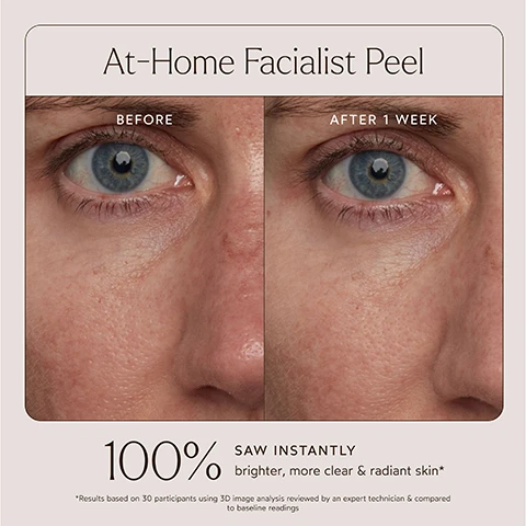 Image 1 - Image shows a side-by-side comparison of a persons face labeled Before on the left and After 1 Week on the right, illustrating improvements in skin clarity; visible text includes At-Home Facialist Peel, 100% SAW INSTANTLY brighter, more clear & radiant skin, and asterisked note about results based on a study.
Image 2 - Image shows a side profile of a persons jawline with skin conditions before and after four weeks of using an at-home facialist peel, with visible text stating At-Home Facialist Peel and 97% of participants said their skin texture was instantly improved.
Image 3 - A jar of facial cream sits on a light green surface, with text stating that 100% said their skin was instantly brighter, 97% said their skin feels smooth, and 97% saw significant improvement in fine lines and wrinkles after one use.
Image 4 - An at-home facialist peel product advertisement featuring a light green background with text highlighting benefits such as smoothing fine lines, brightening dull skin, and hydrating for a glass-like complexion in 15 minutes, with symbols indicating it is clinically proven, hypoallergenic, and vegan.
Image 5 - Image of a skincare product with a clear jar labeled TRUE BOTANICALS AT-HOME FACIALIST PEEL surrounded by green aloe leaves and water droplets, featuring the text 4 Potent Acid Blend and descriptions for Aloe Leaf Juice and Electrolyte Mineral Complex.
Image 6 - An informational graphic highlighting the MADE SAFE certification for True Botanicals products, featuring a list of banned substances such as Sodium Lauryl Sulfate and parabens, along with text stating MADE WITH SAFE INGREDIENTS and mentioning the certifications safety standards.