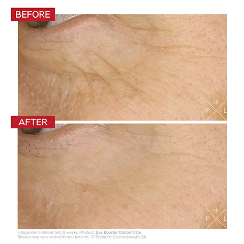 Image 1, BEFORE dr P AFTER Independent clinical test, 8 weeks. Product: Eye Booster Concentrate. Results may vary with different patients. O Scientific Cosmeceuticals SA dr P L Image 2,  Dr. LEVY SWITZERLAND на на на на на на на на на на нЖ нннннн INTENSE STEM CELL Eye Booster Concentrate Concentré Activateur Contour des Yeux Just as many opportunities to enhance your gaze Coulon 002 Депк