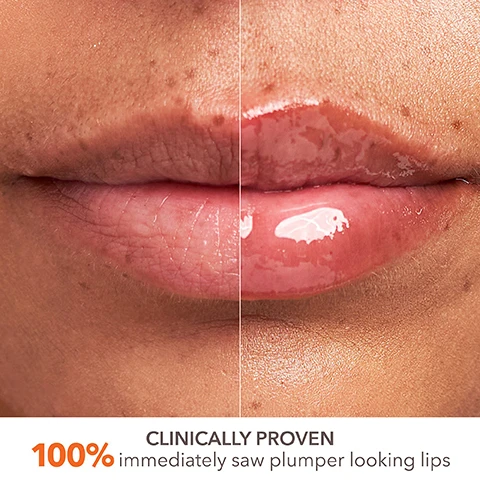 Image 1, clinically proven 100% immediately saw plumper looking lips. image 2, 2 times lip volume. based on clinical study of 25 subjects, as compared to bare lips. image 3, clinically proven. 100% immediately saw enhanced lip colour. image 4, clinically proven. 96% immediately saw improvement in chapped lips. image 5, clinical proof. 100% immediately saw plumper looking lips. 100% immediately saw enhanced lip colour. 88% said they would replace their lip filler with this product. image 6, multiple weights of hyaluronic acid - plumping hydration for fuller looking lips. peptide complex - firms and adds volume to lops. bisabolol ectoin - heal, prevent dryness and repair chapped lips. image 7, this is a powerful plumper. stay within the lines. image 8, tips for lips. wear alone, layer with favourite lip liner. layer with favourite lip stick. image 9, all lips are unique, you may or may not feel a tingling sensation. image 10, perfect pairing for plumped defined lips. step 1 = boost collagen and visibly reduce fine lines and wrinkles. step 2 = immediately plump and hydrate lips.