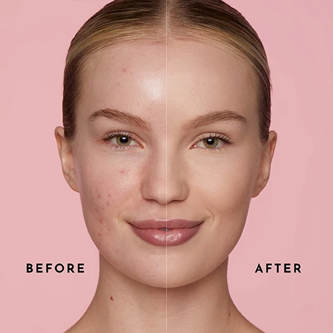 Image 1 - A split image shows a womans face divided down the middle: the left side displays acne and blemishes labeled BEFORE, while the right side shows clear, smooth skin labeled AFTER, with a pink background.
Image 2 - A smiling woman with long blonde hair holds a makeup brush in one hand and a compact in the other, with a pink background; visible text reads ANNIE IS WEARING MEDIUM.
Image 3 - A background featuring a gradient from pink to light pink with various shades of makeup powder scattered across the image, accompanied by text that reads TALC FREE, ABSORBS SHINE, PREVENTS MOISTURE LOSS, and SMOOTHS AND PERFECTS.
Image 4 - An image featuring a woman smiling while holding a makeup brush, with text listing agreement percentages about a beauty products effectiveness, stating that 96% agree it is easy to apply, 93% agree it smoothes the skin, 90% agree it evens out skintone, and after 12 hours, 90% agree it minimizes the look of pores and imperfections.
Image 5 - A woman with reddish-brown hair is shown with a clear division down her face, highlighting the effects of two different powders; the left side is labeled FLASHBACK BEST-SELLING POWDER, showing a matte finish, while the right side is labeled NO FLASHBACK PERFECTING POWDER, showing a more natural appearance, with the text SHADE: FAIR at the bottom.