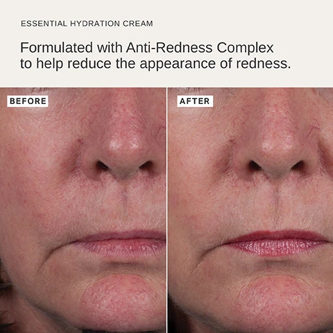 Image 1 - Before and after images show a close-up of a womans face focusing on her nose and mouth area, illustrating reduced redness after using essential hydration cream; visible text includes BEFORE on the left and AFTER on the right, along with labels for the product and its benefits.
Image 2 - Image of a tube of Alpha-H Essential Hydration Cream with a creamy texture spread beside it, labeled with benefits such as Anti-Redness Complex, Red Algae Extract, Palmitoyl Tripeptide 5, and Ylang Ylang + Peppermint, along with their respective descriptions and details including size 50ml and 1.69 fl. oz.