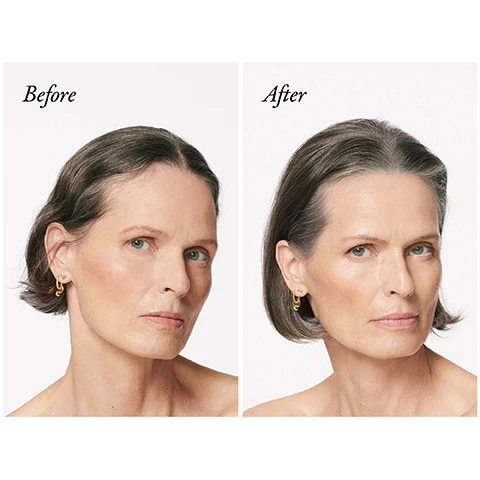 Image 1 - Split image of a womans face showing a before and after comparison with the text Before After. Image 2 - Side by side comparison image shows a persons hair looking thinner on the left and fuller on the right with the text Before and After. Image 3 - A blurred and a focused purple Oribe Serene Scalp Densifying Treatment bottle are shown next to text that reads Serene Scalp Densifying Treatment After 1 month: 85% saw an improvement in the appearance of their hair¹ After 2 months: 86% said their thinning hair looks thicker¹ After 3 months: More than 8 in 10 said their hair felt significantly fuller¹ ¹Based on a 90-day consumer panel survey of 102.