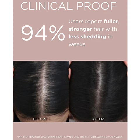 Image 1 - Image showing a comparison of hair before and after treatment, with the left side labeled BEFORE and the right side labeled AFTER, along with text stating 94% Users report fuller, stronger hair with less shedding in weeks and a note about the participants using a hat.
Image 2 - A woman with freckles and red lipstick smiles while wearing a black cap, and the image includes the text PRECISION LIGHT THERAPY FOR STRONGER, FULLER HAIR and HANDS-FREE CORDLESS EFFORTLESS.
Image 3 - Image shows a promotional graphic for light therapy with red and deep red light therapy details on top and blue light therapy information below, text includes the benefits of each therapy: Red + Deep Red Light Therapy (630nm + 660nm) - Boosts circulation, strengthens hair at the root to minimize shedding & breakage and Blue Light Therapy (420 nm) - Helps balance the scalp for optimal hair density & resilience.
Image 4 - Image shows a black adjustable dad hat with a red light therapy panel on top, featuring text that states Quick 10 Minute Daily Session, Removable Insert, Wireless & Hands Free, Hidden Small Battery, 100% Cotton, Adjustable Dad Hat, and 48 LED, 96 Diodes - Medical Grade.
Image 5 - A close-up of a woman wearing a black baseball cap with the words DAY OF OFFICE. and SLAY on it, featuring a bronzed complexion and earrings, with text below that reads REAWAKEN WEAK HAIR AT THE ROOT—POWERED BY PRECISION LIGHT.
Image 6 - Image shows a light pink background with three sections each containing a bold title and a description, explaining the benefits of scalp health: REDUCES EXCESS SHEDDING followed by text about light reawakening follicles, STRENGTHENS HAIR AT THE ROOT with text about supporting denser hair, and RESTORES SCALP BALANCE describing the effects of red and blue light.
Image 7 - Image shows a FAQ section with questions and answers related to product usage, including adapter types, troubleshooting, charging cords, warranty, and usage duration for effective results. The visible text includes: FAQ, WHAT ADAPTER DO I USE?, Important: Make sure to use 5V 1 or 2 AMP adapter plug and not branded Apple/Samsung etc as it can damage the battery permanently., MY HAT ISN’T WORKING?, Contact Solaris directly to troubleshoot any issues as most can be resolved by resetting the product., WHAT IF I LOSE MY CHARGING CORD?, The insert uses a TYPE C cord so you can use any type C cord or brand to charge if you lose yours., WHAT IS MY WARRANTY?, You have 1 year warranty for factory malfunctions or defects. Please contact Solaris Labs directly with any troubleshooting or issues., HOW LONG DO I USE & WHEN DO I SEE RESULTS?, The hat is used for a total of 10 minutes a day, 3-5 days a week. Results are visible on average around 10-12 weeks in but less breakage and shedding occurs after 2 weeks.