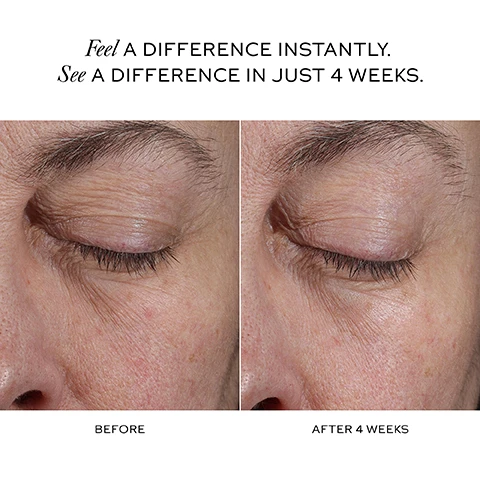 Image 1 - Before and after comparison image of an eye area showing reduced wrinkles after 4 weeks with the text Feel A DIFFERENCE INSTANTLY. See A DIFFERENCE IN JUST 4 WEEKS. BEFORE AFTER 4 WEEKS. Image 2 - A womans face is shown with text reading IN 4 WEEKS, THE EYE AREA* 97% LOOKS SMOOTHER AND LESS CREPEY 97% LOOKS AND FEELS FIRMER 94% LOOKS LESS PUFFY CLINICAL RESULTS +200% HYDRATION** -20.4% DARK CIRCLES*** -18.8% FINE LINES*** *Based on a consumer study, 31 participants, 4 weeks. **Based on clinical study, 31 participants, immediately after use. ***Based on a clinical study, 31 participants, 8 weeks. Image 3 - Close up of pink serum with bubbles, text reads THE ALL-IN-ONE EYE SERUM SMOOTHS, BRIGHTENS, DEPUFFS AND FIRMS EYE CONTOUR 12 POTENT-YET-GENTLE ACTIVES EXOSOME TECHNOLOGY - ONE OF THE MOST EFFICIENT WAYS TO DELIVER ACTIVES TO SKIN DEVELOPED IN PARTNERSHIP WITH KOREAS LEADING SKINCARE SCIENTIST. Image 4 - A dropper with pink serum shown with diagrams illustrating skin improvement and text describing the process and results: STEP 1 BRIGHTENS + DEPUFFS STEP 2 FIRMING + SMOOTHING EXOSOME BOOST Goes deeper into skins surface to jumpstart skin renewal THE RESULT: Smoother, brighter, firmer eye contour 2 STEP, SKIN-SMART SYSTEM LAYERED RELEASE OF STABLE ACTIVES WITHOUT DISRUPTING SKIN. Image 5 - A dropper releasing drops of light pink serum next to text listing the ingredients and benefits of SU PRÊME SKIN BIO-COMPLEX OLIGOPEPTIDE-1, PEPTIDE DUO, NIACINAMIDE Jumpstarts skin renewal; smooths fine lines, brightens dark circles, firms VITAMIN K1 Brightens dark circles, helps prevent sagging and fine lines, soothes ALFALFA EXTRACT, WHITE LUPIN PROTEIN Helps reduce puffiness; tones eye area CERAMIDES, TRIOLEIN Helps restore skin barrier; deeply hydrates HYALURONIC ACID 4 TYPES Firms, plumps and hydrates PULLULAN Helps instantly lift and firm PANTHENOL VITAMIN B5 Hydrates and soothes ALKANET ROOT EXTRACT Helps hydrates; gives formula its light pink hue. Image 6 - Close-up of a persons face with an arrow and stars near the eye and eyebrow area showing where to apply a product with text Apply with ring finger to the under eye and brow bone area, tapping gently in an upwards motion. Image 7 - A white spray bottle labeled WESTMAN ATELIER and a gold dropper bottle labeled WESTMAN ATELIER are shown with text reading YOUR BEST SKIN. ACTIVATED. SKIN ACTIVATOR Softens lines Boosts firmness Intensely hydrates Calms, soothes and EYE ACTIVATOR Smooths crows feet Brightens dark circles Reduces puffiness Firms eye contour. Image 8 - Image showing four steps for makeup application with corresponding products and text: YOUR PERFECT CANVAS, PREPPED. STEP 1: TREATMENT SERUM Skin Activator and/or Suprême C STEP 2: EYE TREATMENT Eye Activator STEP 3: FOUNDATION Choose Your Finish Natural Finish: Vital Skin Foundation Stick Radiant Finish: Vital Skincare Complexion Drops STEP 4: CONCEALER Vital Skincare Concealer.