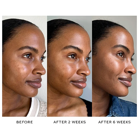 Image 1 - A womans face in profile shown in three stages labeled BEFORE AFTER 2 WEEKS AFTER 6 WEEKS. Image 2 - Close-up of a womans face and shoulder with text overlay reading BOOST BRIGHTNESS. FADE DARK SPOTS. 100% agree skin tone appears more even, uniform 93% saw a visible reduction in appearance of dark spots and/or hyperpigmentation 93% agree skin looks significantly brighter *BASED ON A CONSUMER STUDY 30 PARTICIPANTS, 8 WEEKS. Image 3 - A gold bottle labelled WESTMAN ATELIER with an orange and green leaf on top, with text reading 100% THD ASCORBATE STABLE VITAMIN C DERIVATIVE POTENT-YET-GENTLE. SAFE FOR ALL SKIN TYPES. (Including sensitive skin!) GEL-OIL SYSTEM OPTIMIZES ACTIVE DELIVERY. Image 4 - Clear droplets or bubbles on a gray background with text that says SPRINGY, GEL-OIL (a little goes a long way) SAFE FOR ALL SKIN TYPES NO SILICONES NO ADDED FRAGRANCE NON-COMEDOGENIC. Image 5 - Two bottles, one light pink and one gold, with matching caps, on a surface with the text INCREDIBLY BALANCED SKIN. SKIN ACTIVATOR Softens lines Boosts firmness Intensely hydrates Calms, soothes SUPRÊME C Evens tone Fades dark spots, hyperpigmentation Boosts brightness WESTMAN ATELIER. Image 6 - Image shows components of a reusable and recyclable fragrance product including a glass refill bottle, outer case, and cap with text RECYCLABLE & REFILLABLE, REMOVE AND REUSE PUMP FOR REFILLS, RINSE GLASS INSERTS & RECYCLE, Reusable pump, Reusable packaging, Glass refill, and WESTMAN ATELIER.
