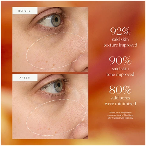 Image 1 - Close-up before and after images show the same persons cheek and eye area, with the top BEFORE image showing skin with visible pores and the bottom AFTER image showing noticeably smoother skin with minimized pores, accompanied by text stating 92% said skin texture improved, 90% said skin tone improved, 80% said pores were minimized, Based on an independent consumer study of 51 subjects after 4 weeks of use, twice daily. Image 2 - A bottle of KORA Organics Turmeric Glow Drops serum is shown with turmeric powder and root nearby, displaying text that reads KORA ORGANICS TURMERIC GLOW DROPS NIACINAMIDE ALTERNATIVE SERUM Sérum à lalternative au niacinamide REFINE + GLOW 30 ml 1.01 fl oz, alongside three circular icons illustrating ingredients with their benefits, which state TURMERIC brightens + improves skin tone, CROWBERRY + BIRCH BARK niacinamide alternatives even skin tone + texture while calming, and HYALURONIC ACID + ATLANTIC SEA WATER lock in moisture + reduce the look of pores. Image 3 - A collection of four KORA Organics Turmeric Glow skincare products is displayed on a clear shelf against a light blue background with blurred orange flowers, showing a golden tube labeled KORA ORGANICS TURMERIC BRIGHTENING & EXFOLIATING SCRUB + MASK Gommage exfoliant & masque éclat au curcuma DETOX + GLOW 100 mL 3.38 FL. OZ., a clear pump bottle labeled KORA ORGANICS TURMERIC GLOW FOAMING CLEANSER Nettoyant moussant éclat au curcuma VITALITY + GLOW 150 mL 5.0 FL. OZ., a small dark dropper bottle labeled KORA ORGANICS SHIMMER GLOW DROPS Gouttes illuminatrices éclat 30 mL 1.0 FL. OZ., and an amber jar labeled KORA ORGANICS TURMERIC GLOW MOISTURIZER Hydratant crème éclat au curcuma HYDRATE + GLOW 50 mL 1.7 FL. OZ. Image 4 - An illustration shows how to recycle a brown serum bottle and its dropper, with on-image text reading: KEEP YOUR GLOW WITHOUT THE WASTE HOW TO RECYCLE Turmeric Glow Drops Niacinamide Alternative Serum Remove plastic wiper guard from 30ml size and recycle separately Rinse out any remaining or excess product Recycle the glass bottle Remove the dropper and discard Recycle the glass pipette separately. Image 5 - A comparison chart titled Certified Organic Serum Squad details four Kora Organics serums: Turmeric Glow Drops for Oily, Combo skin, addressing Visible pores + uneven skin tone, to Minimize pores + improve skin tone; Kakadu Plum Vitamin C Serum for All skin types, addressing Dark spots + dullness, to Brighten skin + enhance radiance; Plant Stem Cell Retinol Alternative Serum for Dry, Combo skin, addressing Fine lines + wrinkles, to Improve firmness + plumpness; and Noni Night AHA Resurfacing Serum for All skin types, addressing Uneven texture + dullness, to Resurface skin + improve texture. Image 6 - The image shows four KORA Organics skincare products in a line on an orange background, titled Glow-Getting RITUAL, with products labeled Step 1 Cleanse, Step 2 Mask, Step 3 Treat, and Step 4 Moisturize, and the Step 3 product is a Turmeric Glow Drops bottle that also says 30 ml 1.05 fl.oz. and has an arrow pointing to it labeled Turmeric Glow Drops.